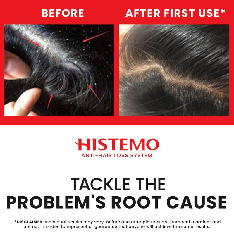 Histemo Hair Loss Prevention & Scalp Care Kit, Scalp Cleanser, Shampoo, Conditioner & Scalp Tonic, DHT Blocking Hair Restoration Treatment (250mL, 200mL, 105mL & 100mL)