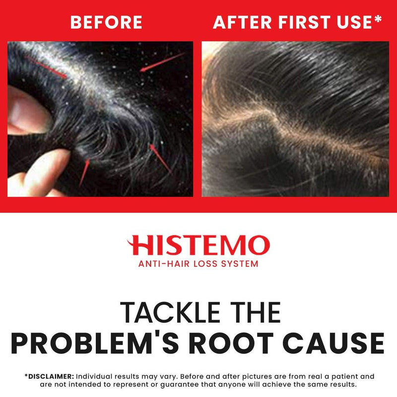 Histemo ION-TO S Scalp Cleanser (105mL)